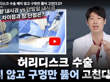 [Yutube - 치료의정석] 허리디스크 내시경 수술, 절개가 작다고 모…