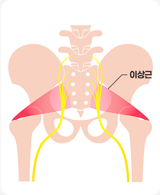 퇴행성 변화